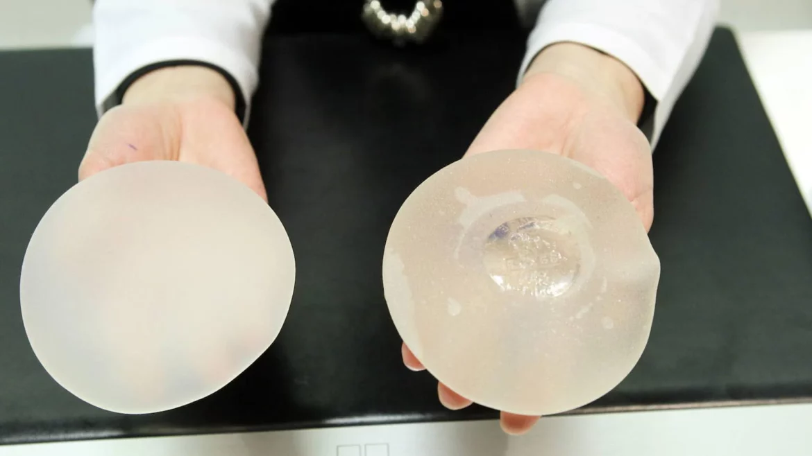 La Región registra 6 casos de linfoma anaplásico de células grandes asociado a implantes de mama