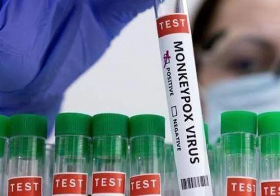 Detectan un caso de viruela del mono en la Región en el último mes