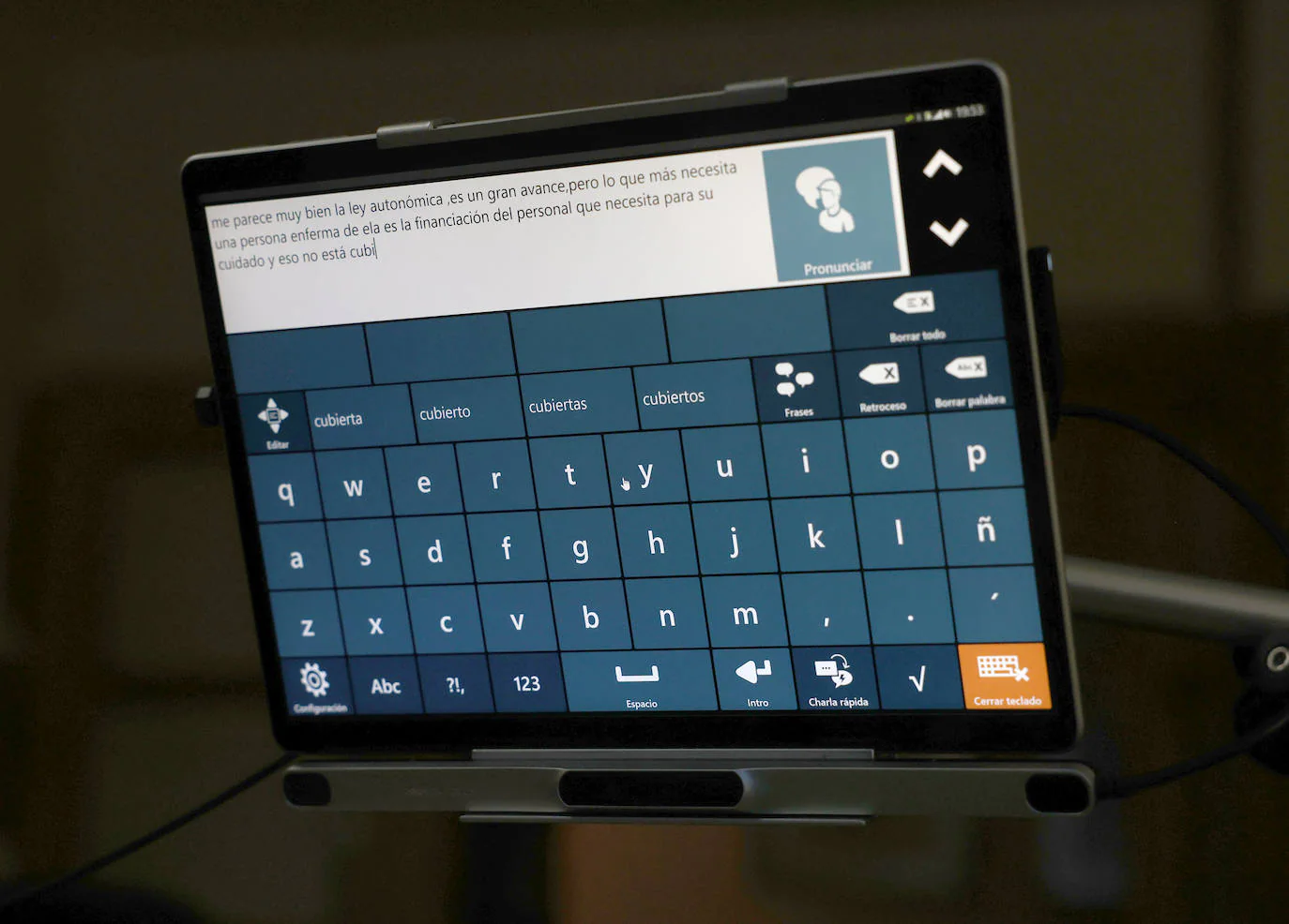 'Tablet' que maneja con sus ojos y que es su única vía de comunicación.