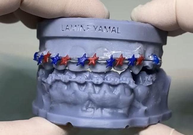 Las joyas dentales ‘Made in Murcia’ que lució Lamine Yamal en el Clásico