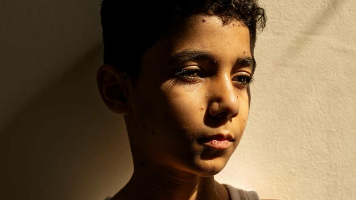 El horror de la guerra de Gaza en un niño mutilado, Foto del Año 2025