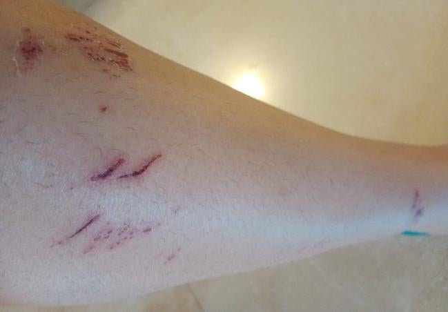 La aparición de nuevos socavones en la Orilla del Azarbe, en Murcia, irrita a los vecinos