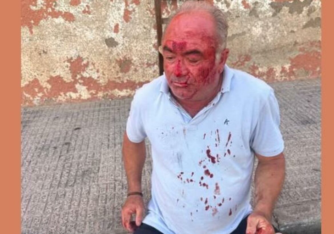 La Guardia Civil investiga la agresión a un vecino de El Algar en un bar