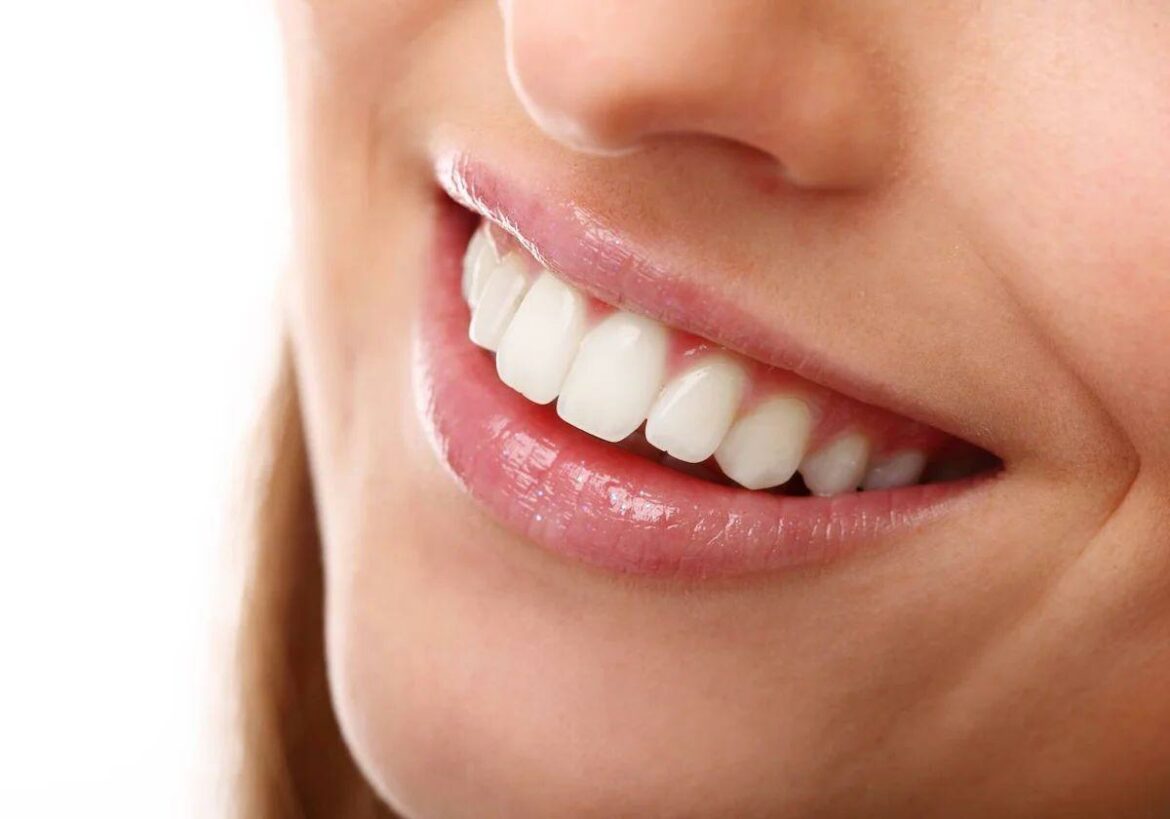 ¿Por qué tus dientes no son blancos aunque los cepilles? Una estudiante de odontología explica los factores más comunes