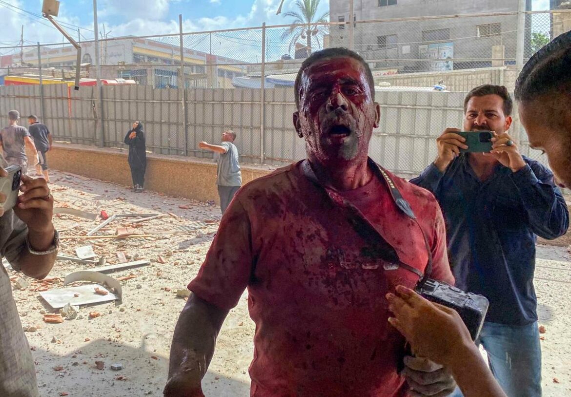 Un doble ataque contra un hospital en Gaza mata a 20 personas, entre ellas 5 periodistas