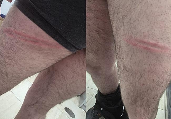 La resaca del Hércules – Real Murcia: aficionados agredidos, enfrentamientos con la policía y barricada en el parking del Enrique Roca