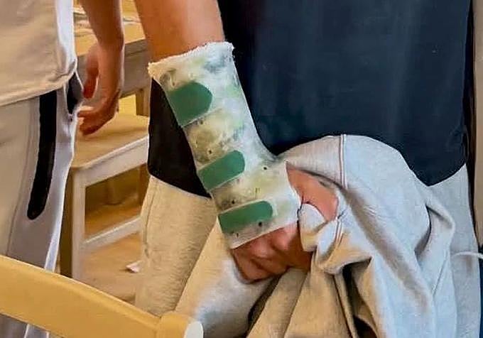 La férula que lleva Alcaraz en su muñeca.